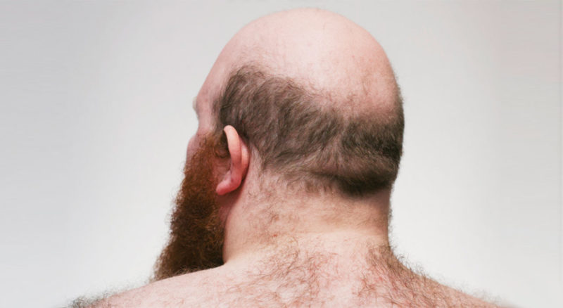 Bob Flesh | Palabra de Oso